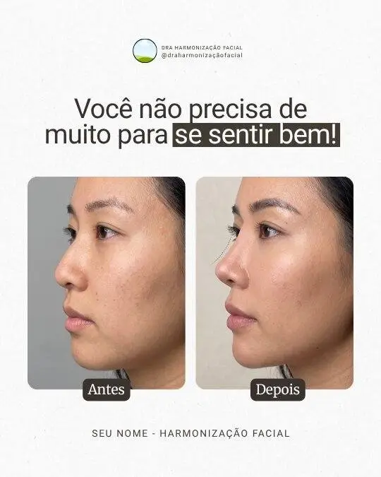 Arte_antes_depois_leveza_hof_full_face